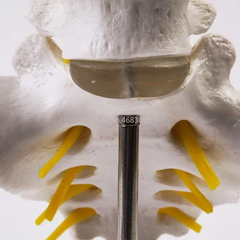 Pavisam Jauna Cilvēka Anatomijas Jostas Skriemeļiem Modeļa Astes Skriemeļu Anatomiju Medicīnas mācību materiāli 32x12x12cm