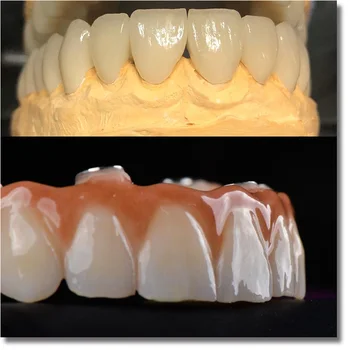 UT extreme 9814mm labāko estētisko efektu cirkonija zobu bloki zobu lab
